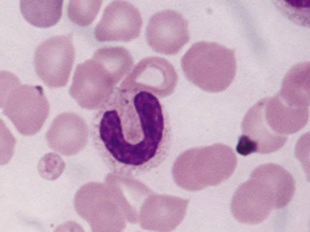 Figure 2 — A Band cell with a non-lobulated nucleus. © BSAVA. Reproduced with permission from the BSAVA Manual of Canine and Feline Clinical Pathology, 3rd edition.