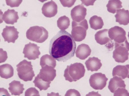 Figure 8 — Medium lymphocyte with more abundant cytoplasm. © BSAVA. Reproduced with permission from the BSAVA Manual of Canine and Feline Clinical Pathology, 3rd edition.