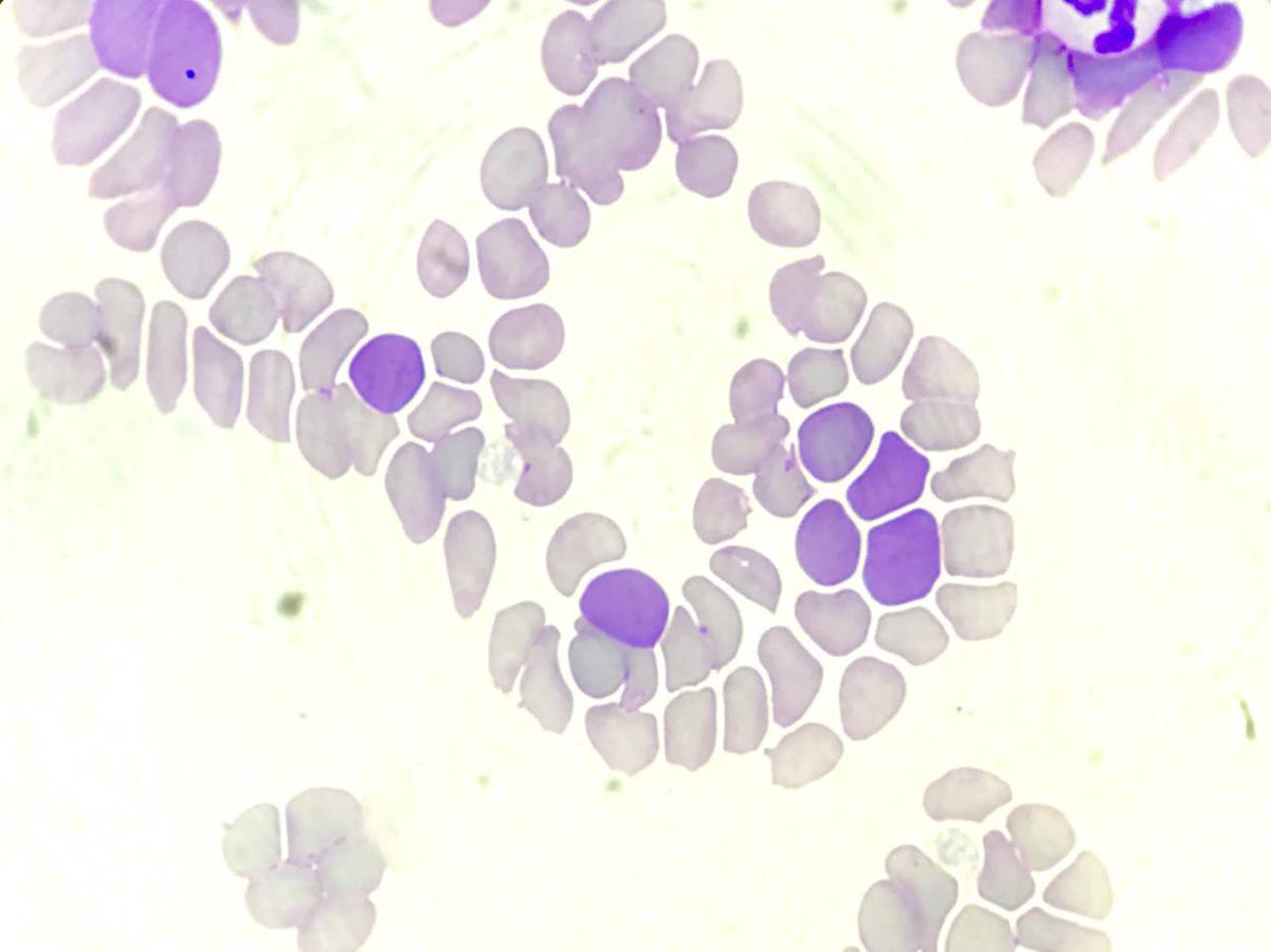 Figure 14 — Polychromasia of red blood cells. Note the blue-grey colour of the cells.