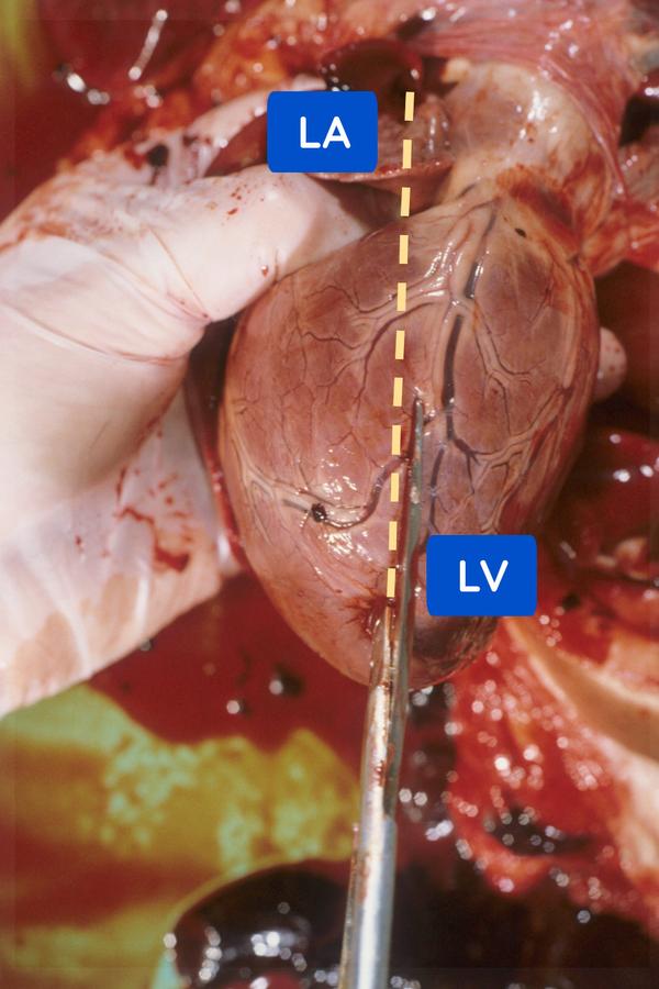 Photo showing dissection of the heart