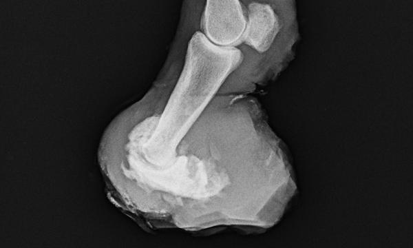 Joint Conditions