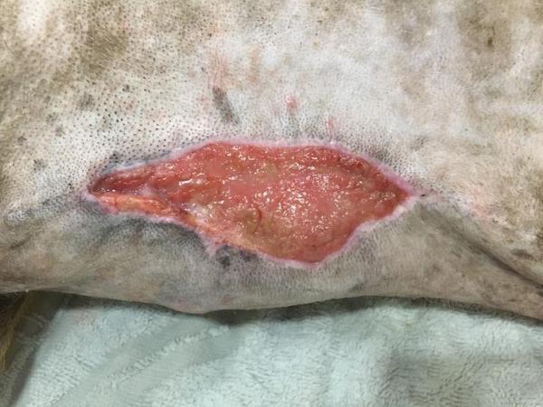 Stages Of Wound Healing