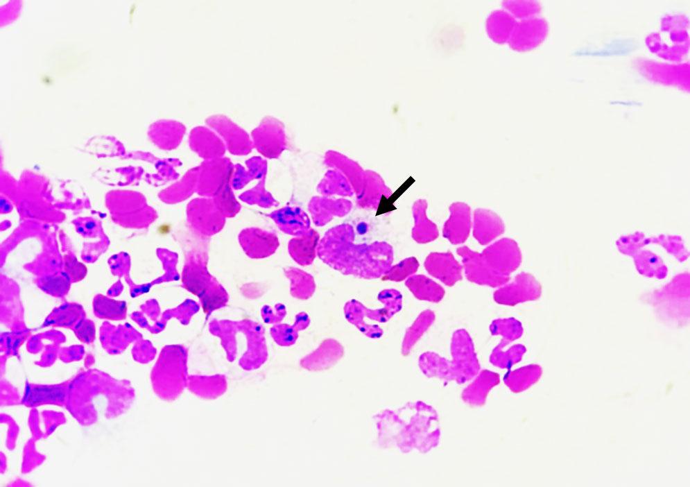 Figure 3. Blood smear showing a morulae within the cytoplasm of a macrophage (arrow)
