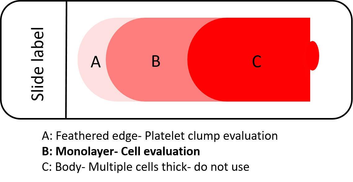 Figure 1 — Diagram of a blood smear showing the correct areas for evaluation