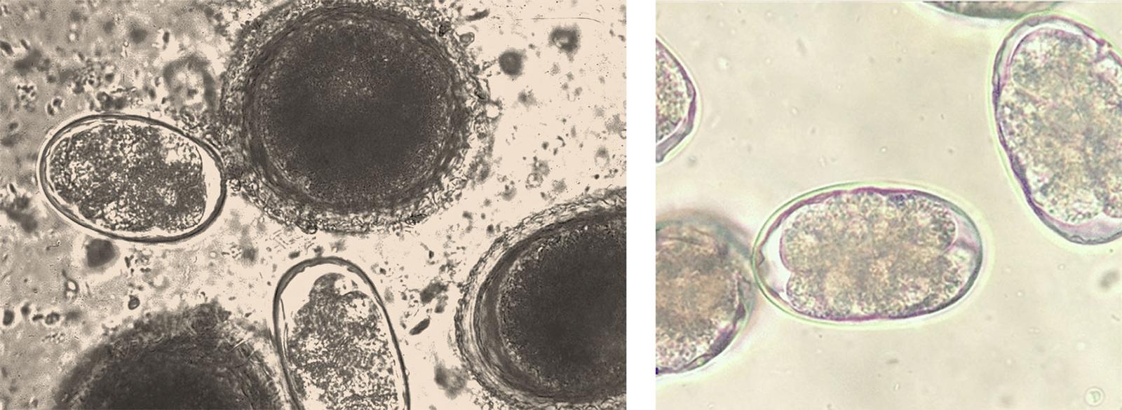 Figure 3 Photomicrographs (x40 magnification) of fecal analyses demonstrating characteristic worm ova (images courtesy of CDC)