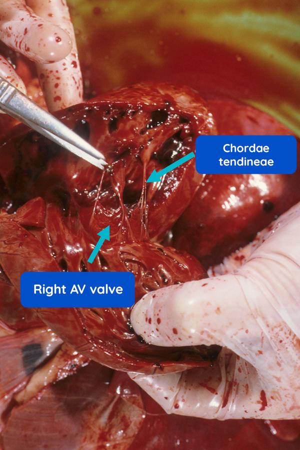 image of inside the heart