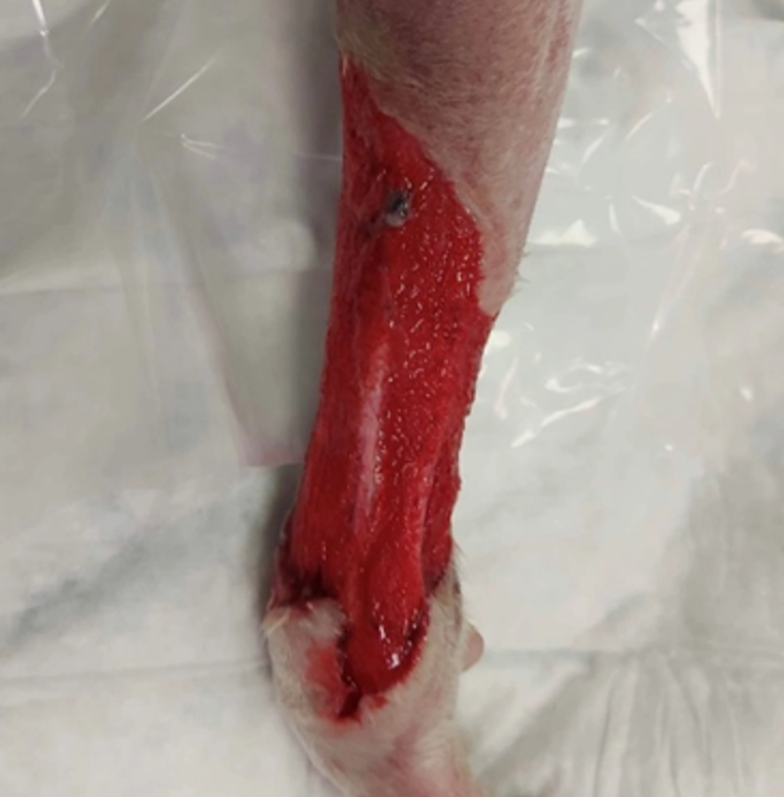 Leg wound showing stages of granulation