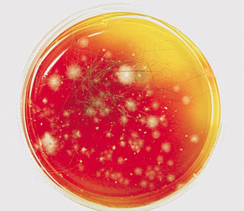 Figure 3 - Dermatophyte culture on Dermatophyte Test Medium showing positive growth after 14 days.