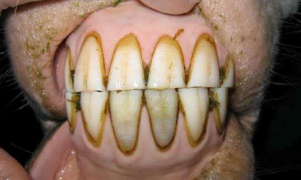 Dental Care