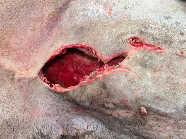 Wound Classification