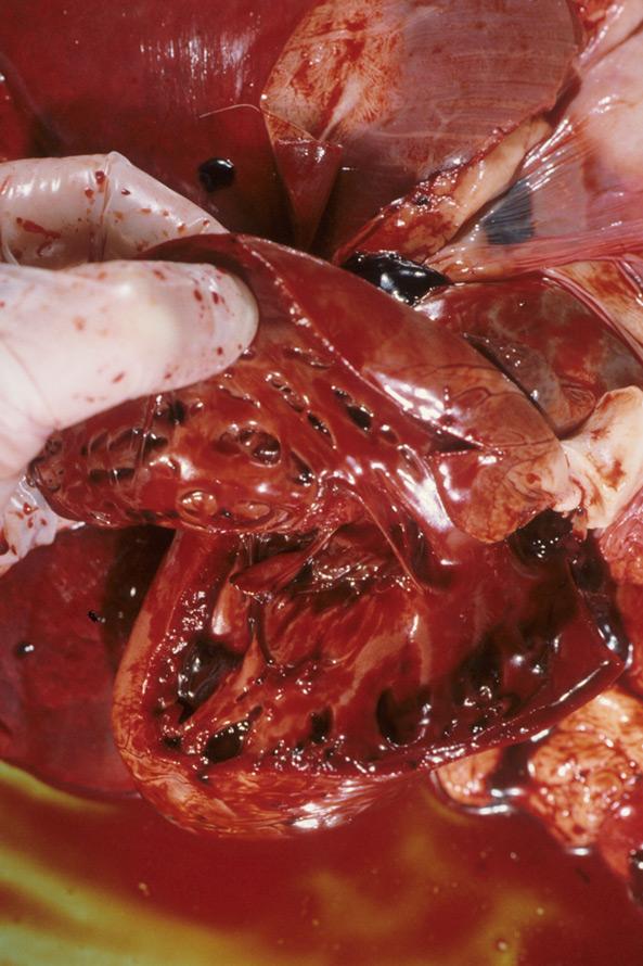 the ventricular wall