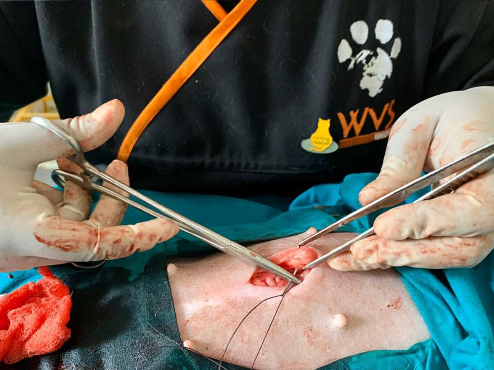 Figure 28 - Ensure that there is no deadspace remaining when you are suturing this layer.