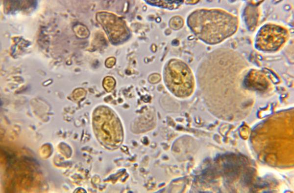 Protozoa