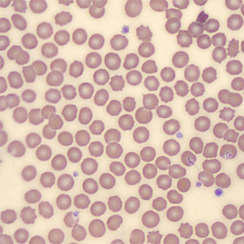 Normal Feline Rbc Normal blood cells | Learn | WVS Academy