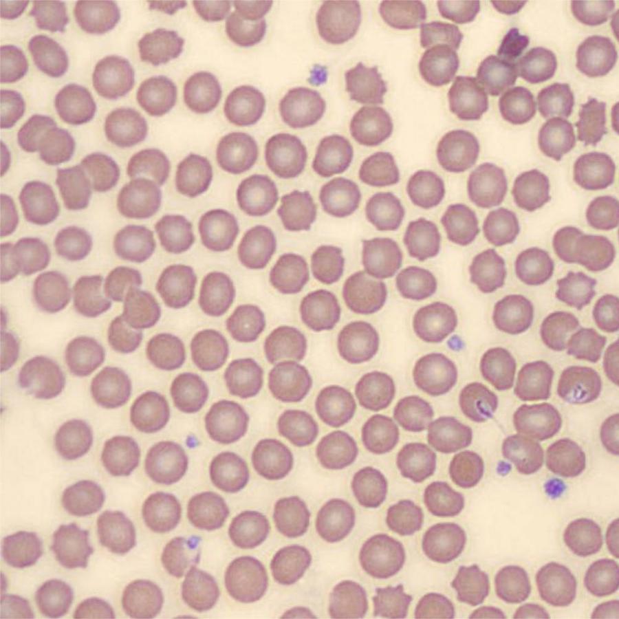 Figure 12