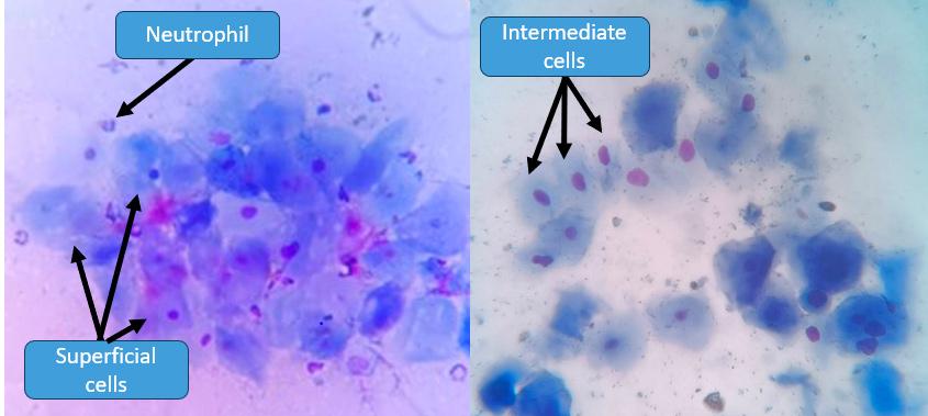 Figure 1 — Vaginal exfoliative cytology – the images show a mixture of intermediate cells, with small nuclei, and superficial cells, with pyknotic or absent nuclei and a ‘cornified appearance’. Neutrophils are also observed.