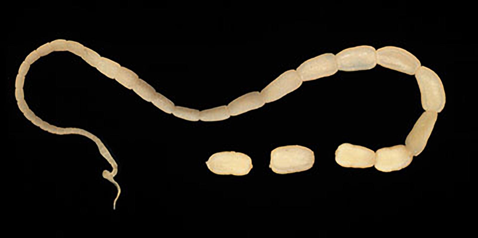 Figure 2 Tapeworm (image courtesy of the Centres for Disease Control and Prevention)