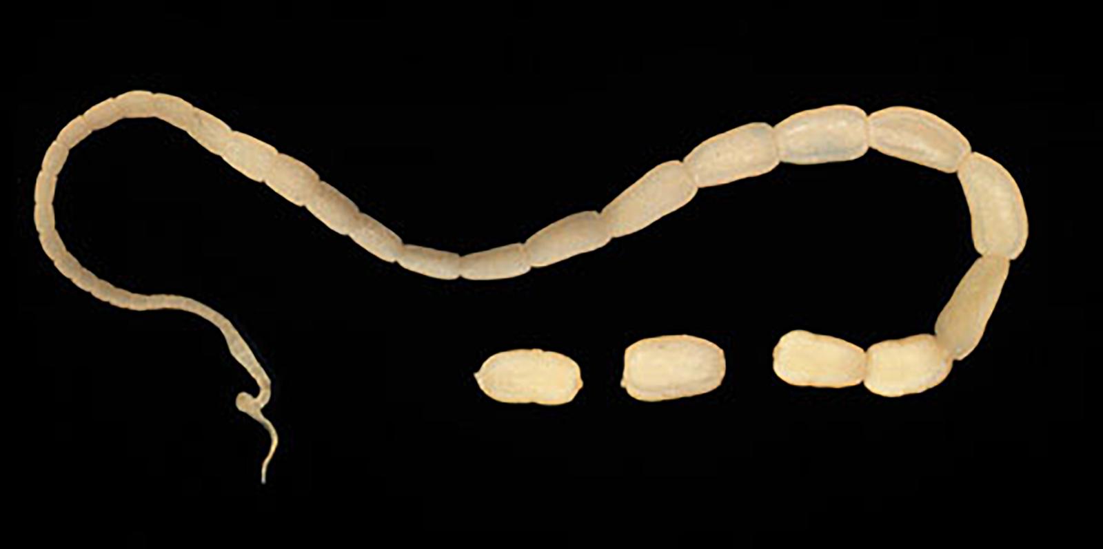 Figure 2 Tapeworm (image courtesy of the Centres for Disease Control and Prevention)