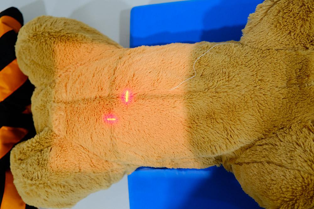 Figure 5 — The beam is centred over the umbilicus and collimated appropriately.