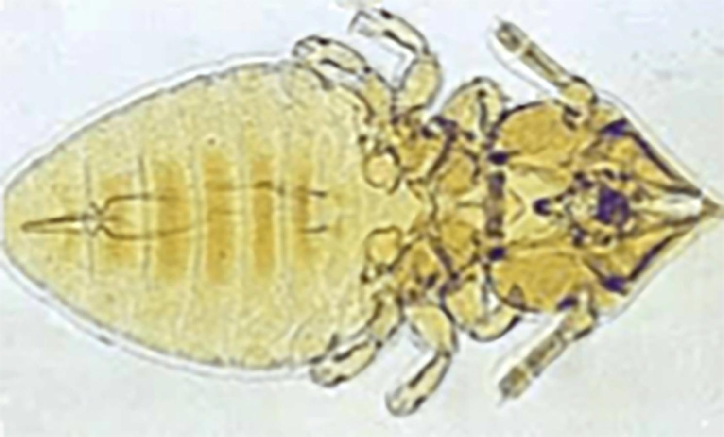 Figure 3 Damilinia equi; the chewing louse