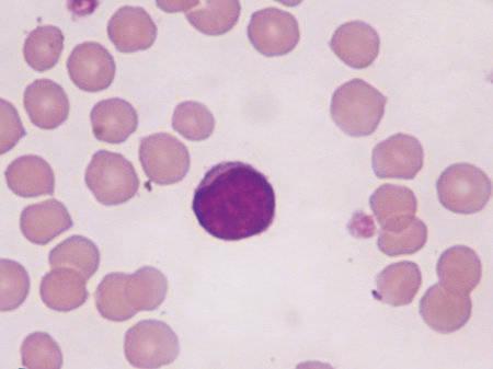 Figure 6 — A small lymphocyte. © BSAVA. Reproduced with permission from the BSAVA Manual of Canine and Feline Clinical Pathology, 3rd edition.