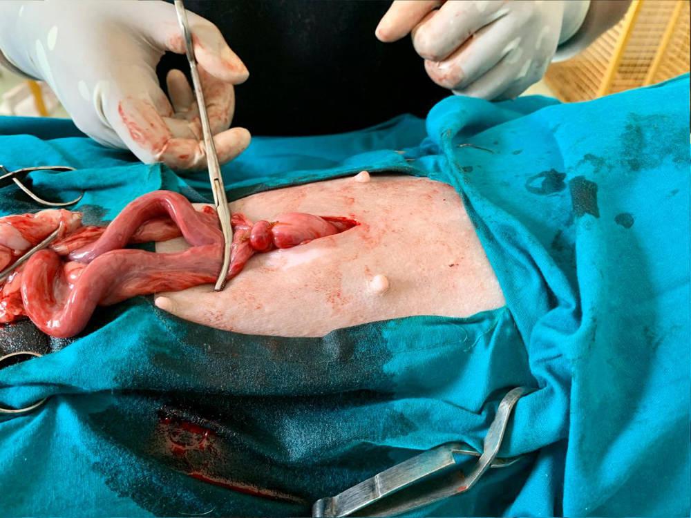 Figure 16 - Second ligature tightened around the crushed tissue.