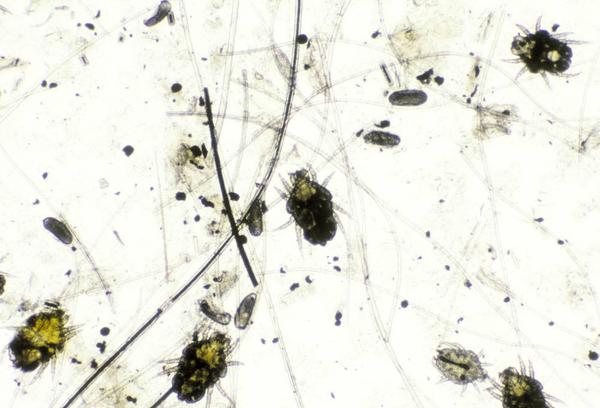 Mites