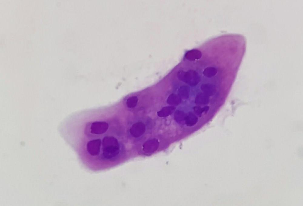 Figure 6. A stained, cellular cast.