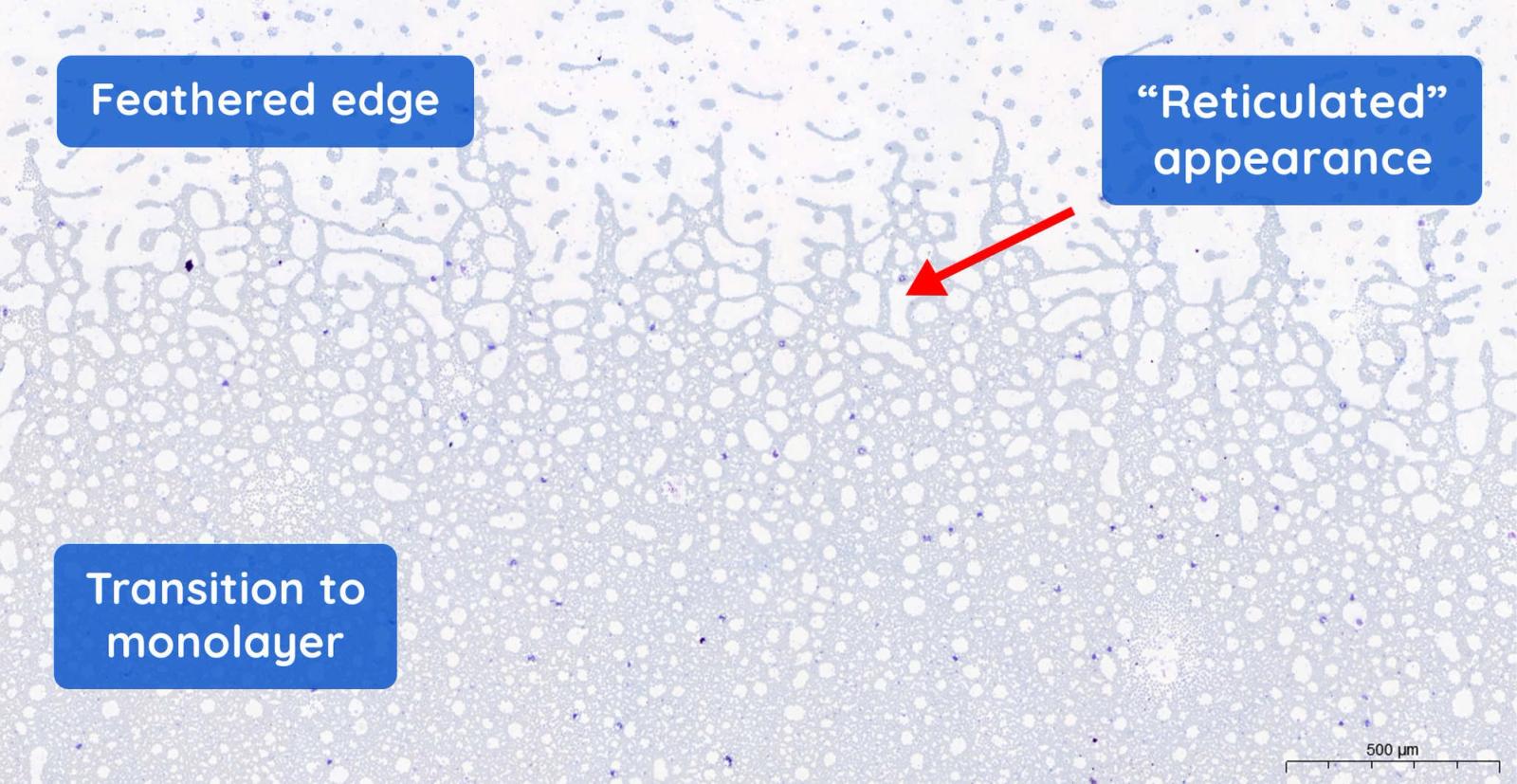 Figure 4 — Reticulated appearance between the feathered edge and the monolayer, with the cells forming pools surrounded by white spaces