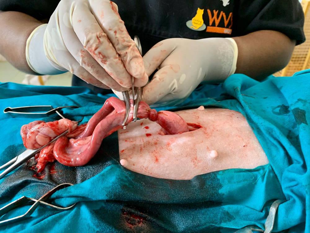 Figure 17 - Another clamp is placed proximal to the first clamp and the tissue between them is transected.