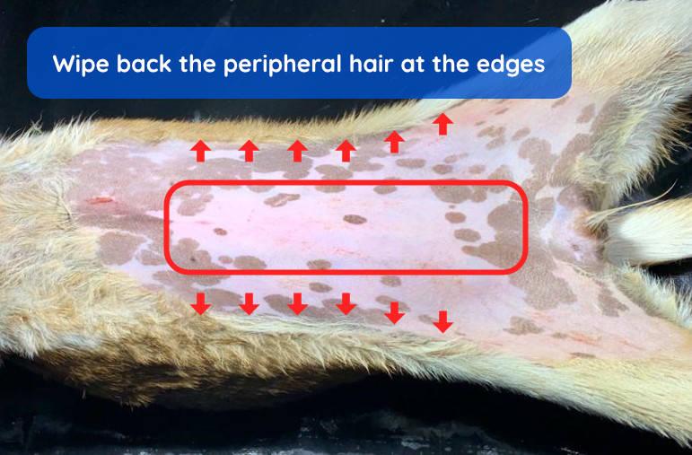 Figure 5 - Wipe back the peripheral hair at the edges.