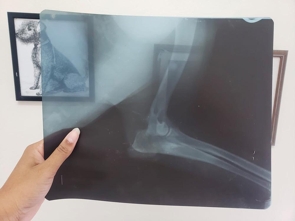 Figure 3 — A clinician holds up a film radiograph.