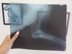 Types of radiography | Learn | WVS Academy