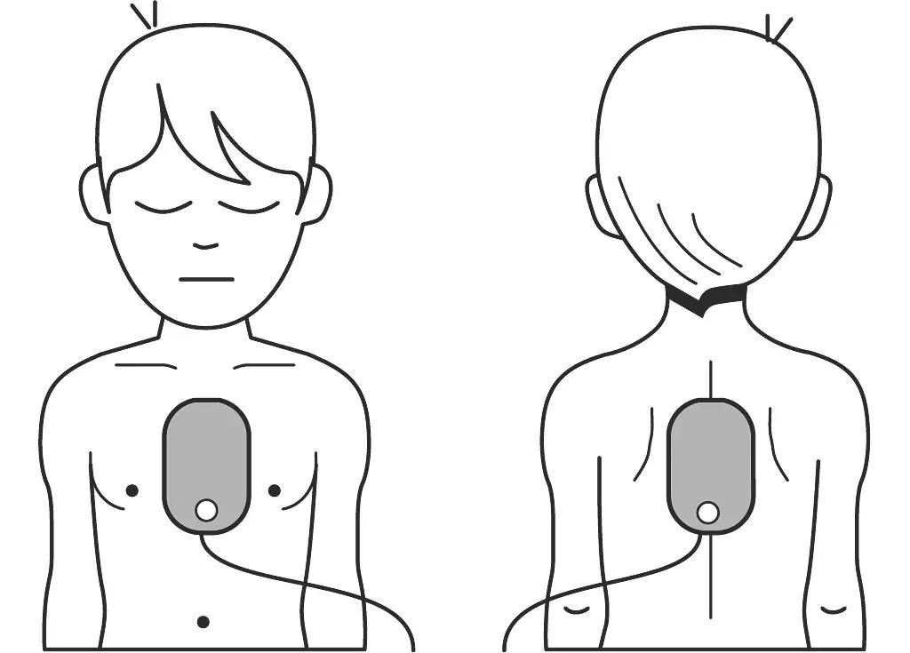 Philips HeartStart FRx AED