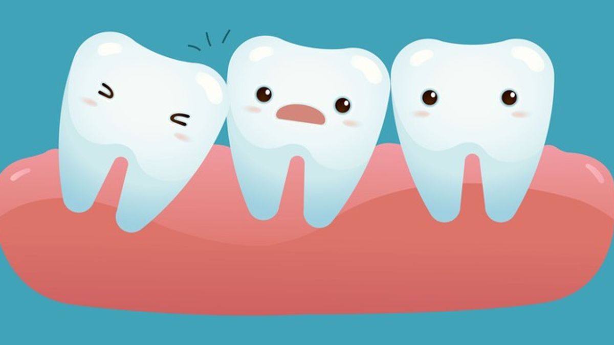 Wisdom Teeth