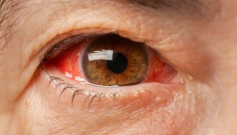 Medición de presión intraocular para prevenir glaucoma