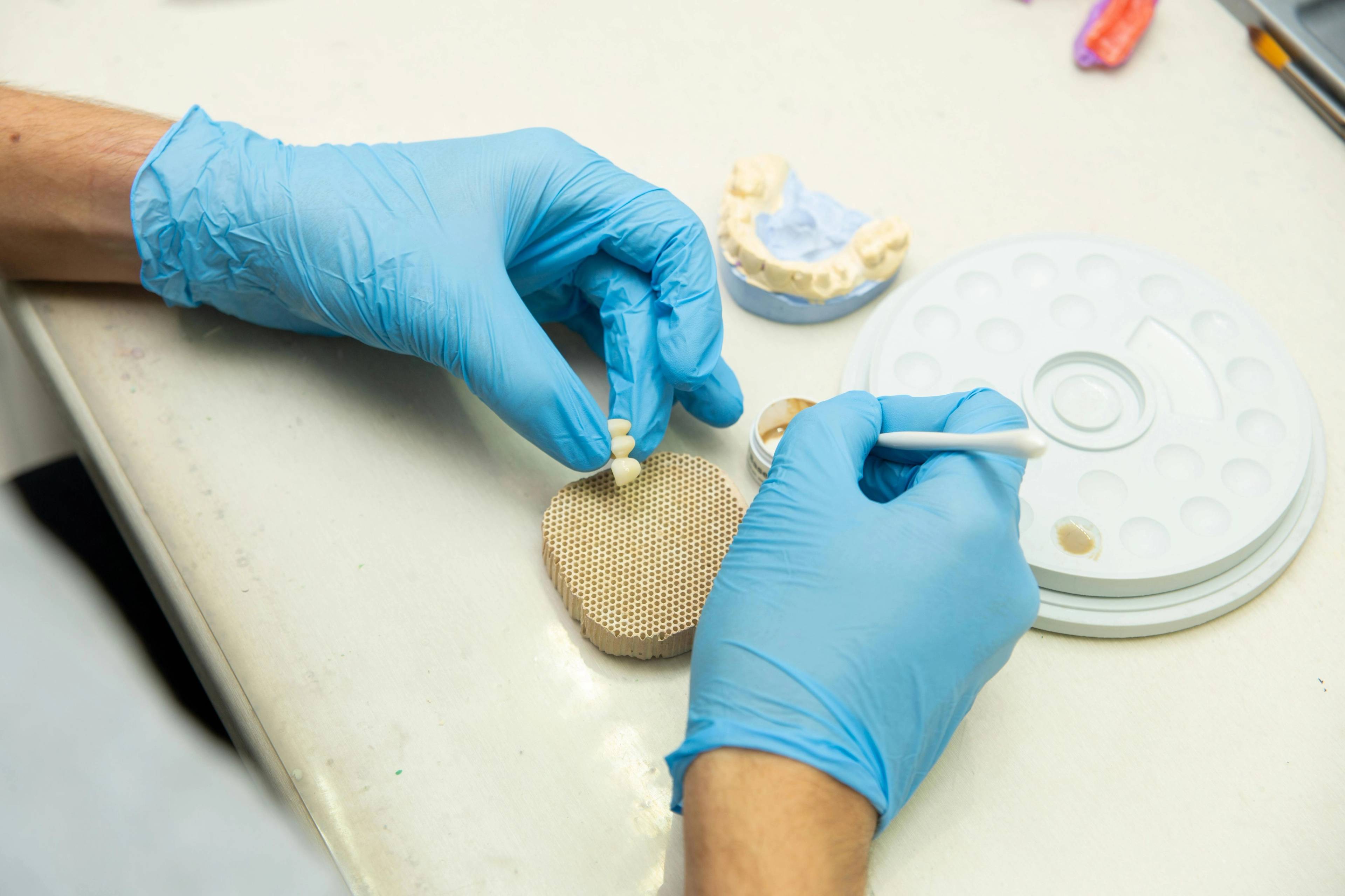 A stock photo of a dentist building a dental bridge