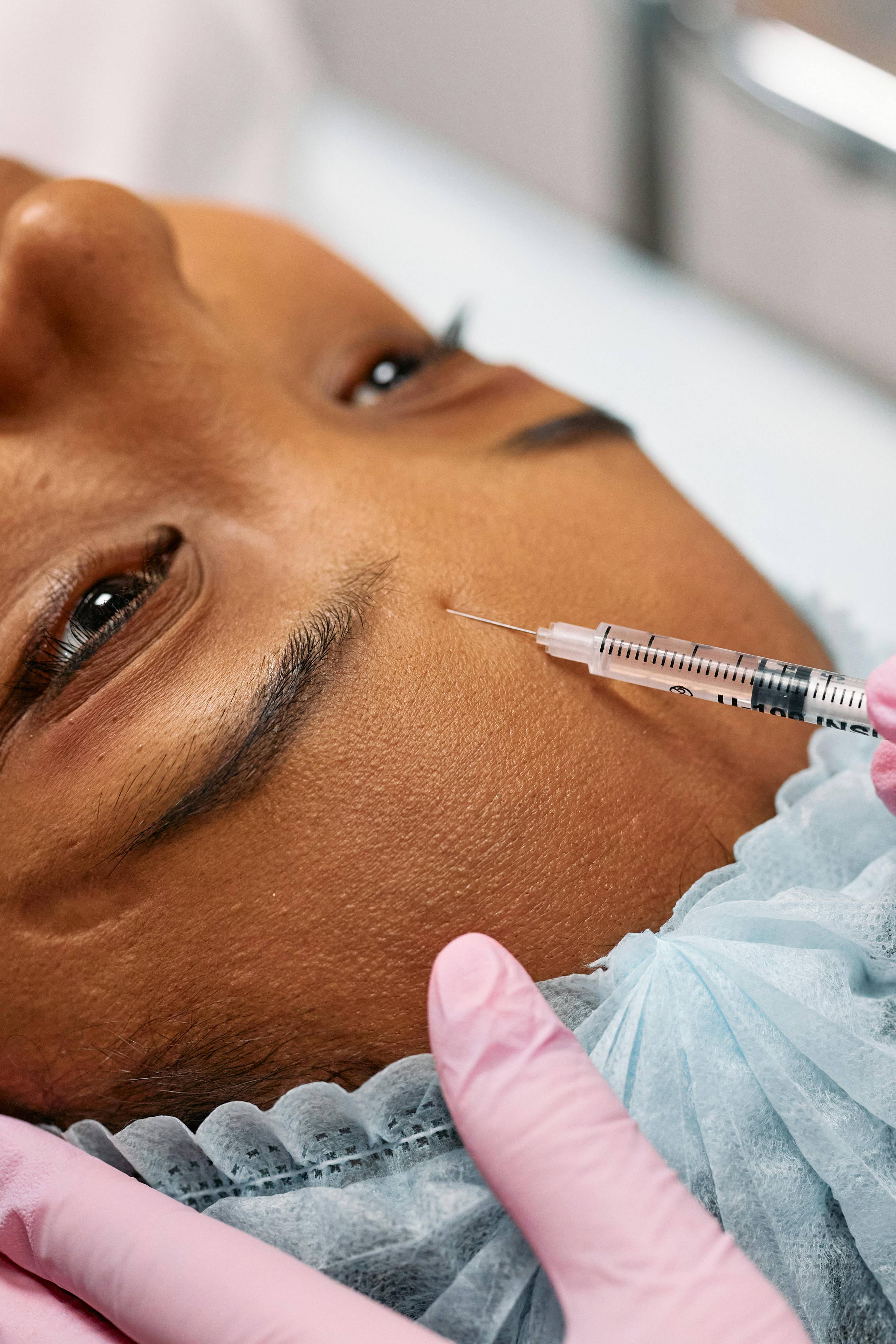 A stock photo of a woman receiving a botox injection in her forehead