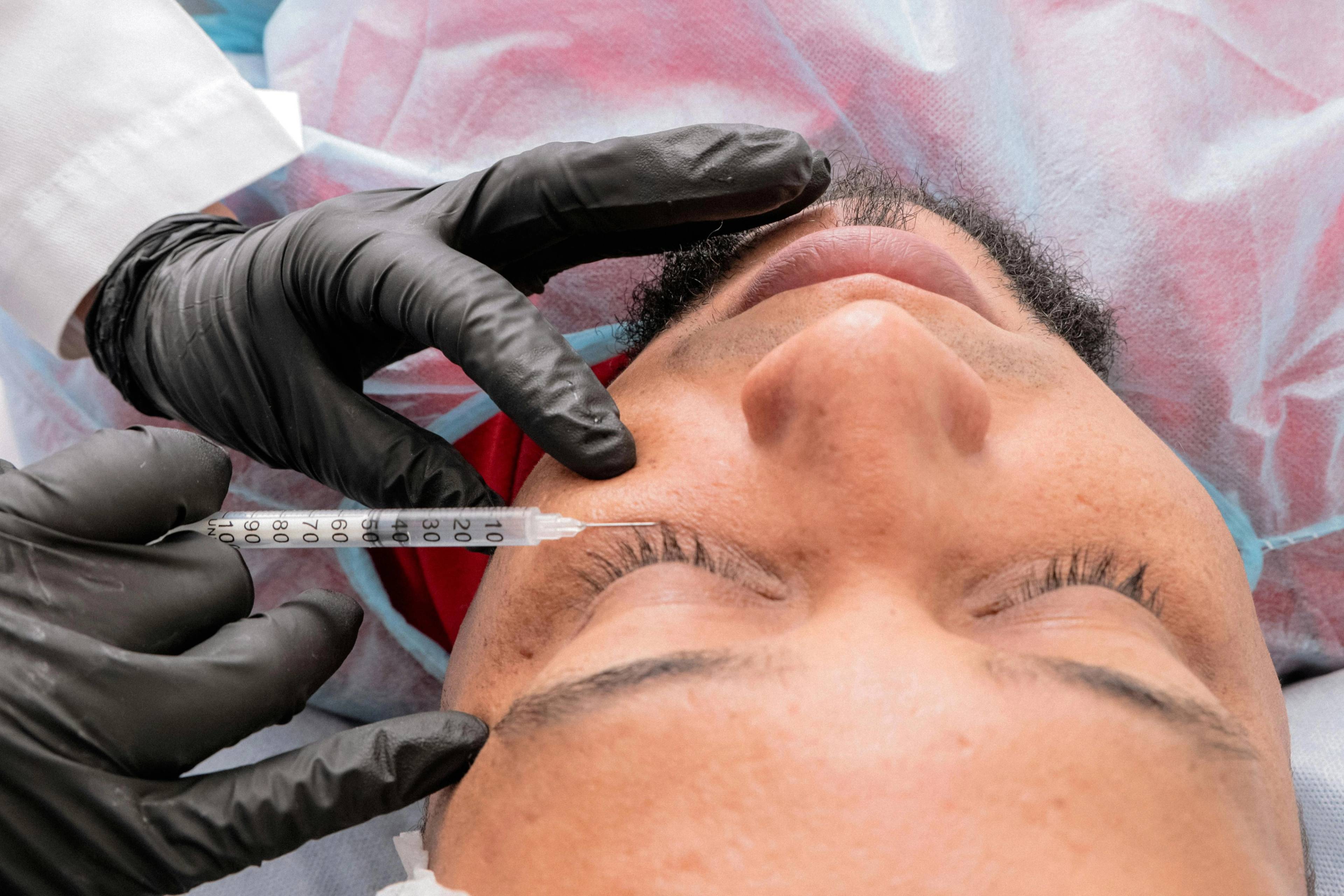 Stock photo of a man receiving under-eye filler