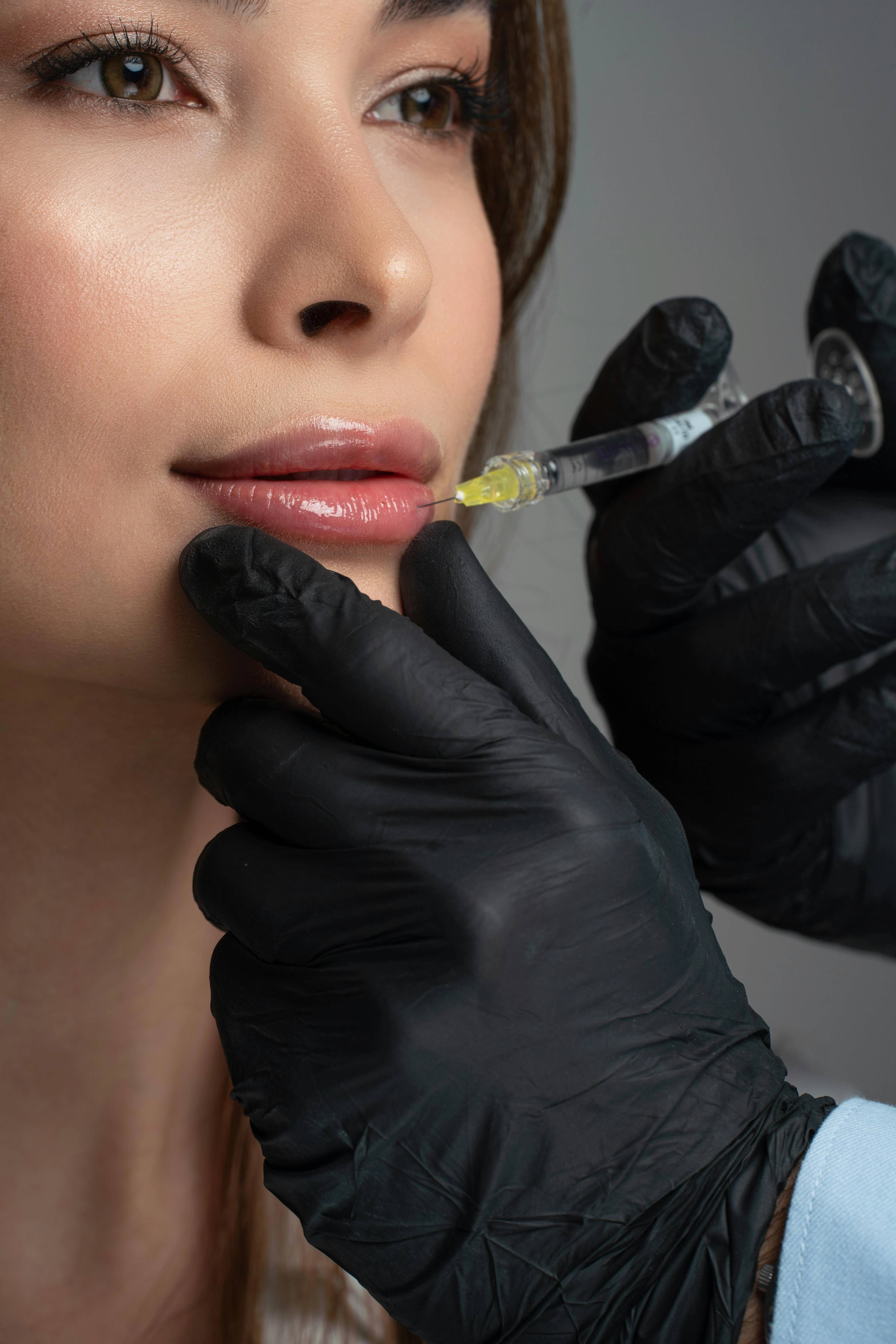 A stock photo of a woman receiving lip filler