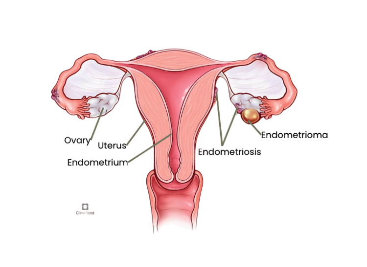 Diagram Cleveland Clinic