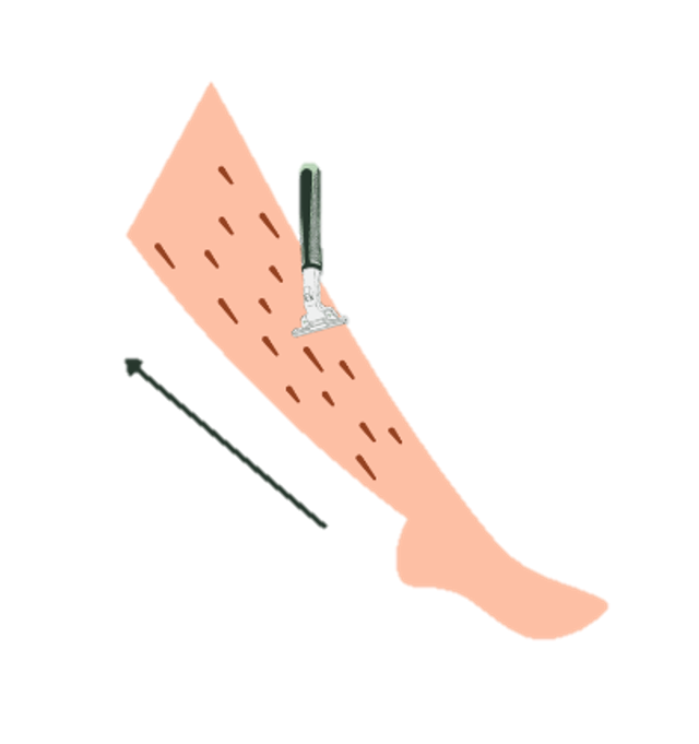 leg 