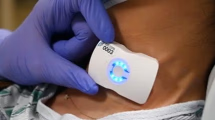 Flosonics partners with BARDA on AI-enabled trauma monitoring