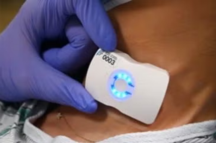 Flosonics partners with BARDA on AI-enabled trauma monitoring