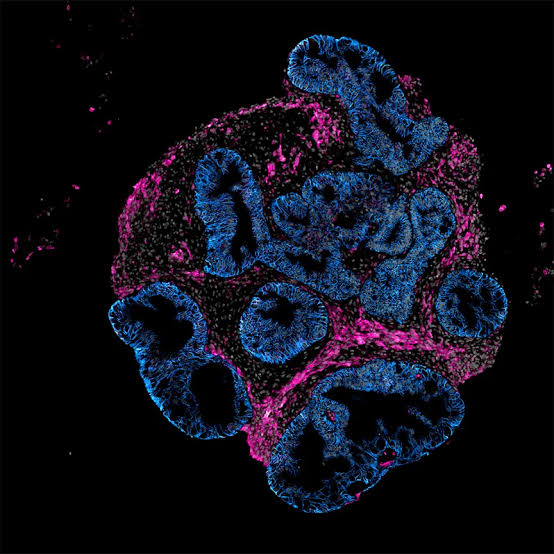 Intero Builds Mini Human Intestines for Drug Testing