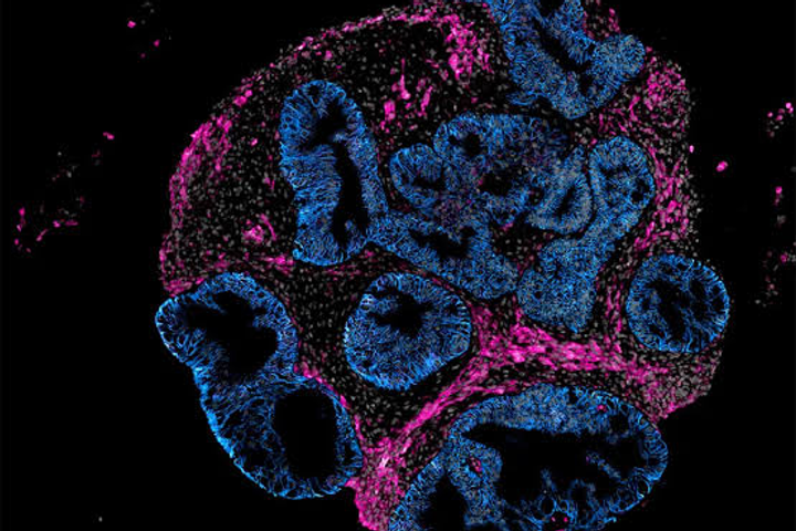 Intero Builds Mini Human Intestines for Drug Testing