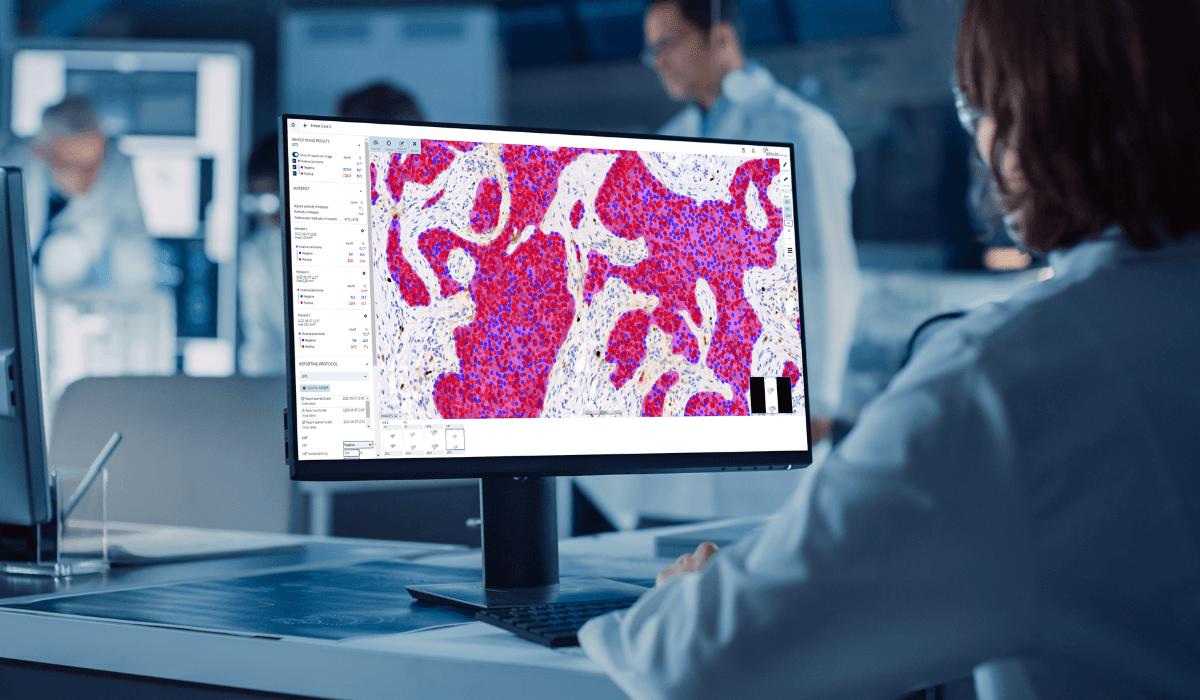 Aiforia Secures €20M for AI Pathology