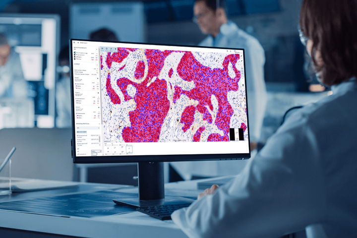 Aiforia Secures €20M for AI Pathology