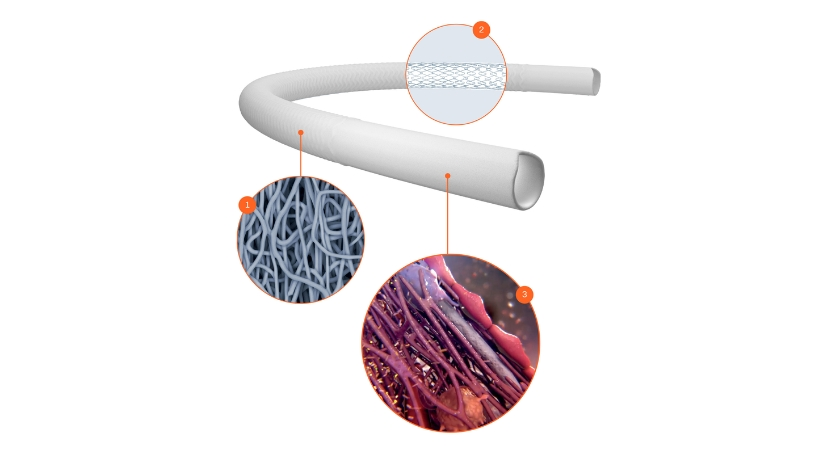 Xeltis Raises €20.5M for Regenerative Implants