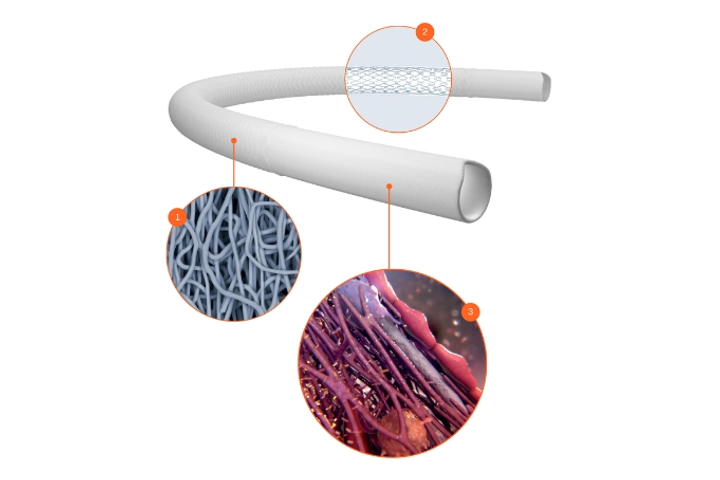Xeltis Raises €20.5M for Regenerative Implants